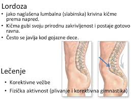 lordoza, pravilan razvoj dece, korektivne vezbe, balet